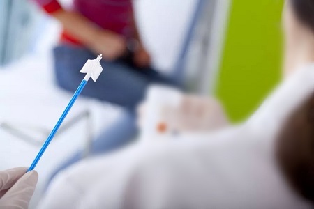 Pokrok v skríningu rakoviny krčka maternice: Úloha testov HPV Seversollection