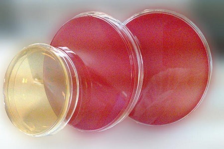 Salmonella shigella agar (SS): základné médium na izoláciu patogénu