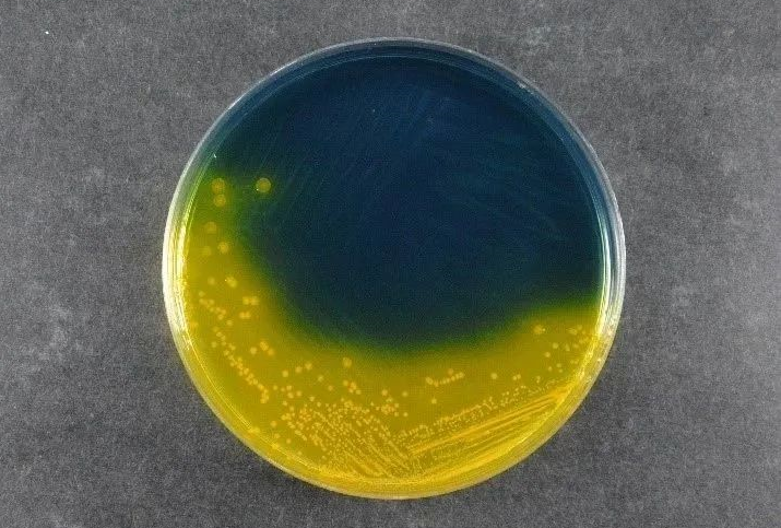 Zabezpečenie bezpečnosti potravín: Salmonella Shigella Agar (SS) spoločnosti Babio podporuje globálne štandardy detekcie patogénov