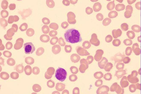 BABIO uvádza na trh vysokokvalitné riešenie GiemSA Stain pre globálne laboratóriá