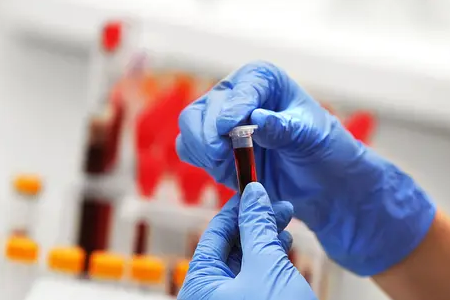 Rýchla detekcia malárie: Testovacia súprava s dvojitým antigénom BABIO posilňuje globálne zdravie