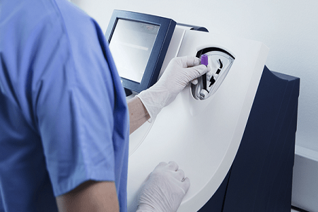 Rýchla detekcia pomocou testovacej karty prokalcitonínu (PCT) od BABIO