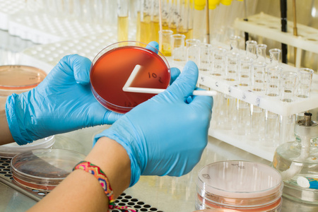 Agarové médium MacConkey od BABIO – prémiová selektívna izolácia pre globálnu mikrobiologickú diagnostiku